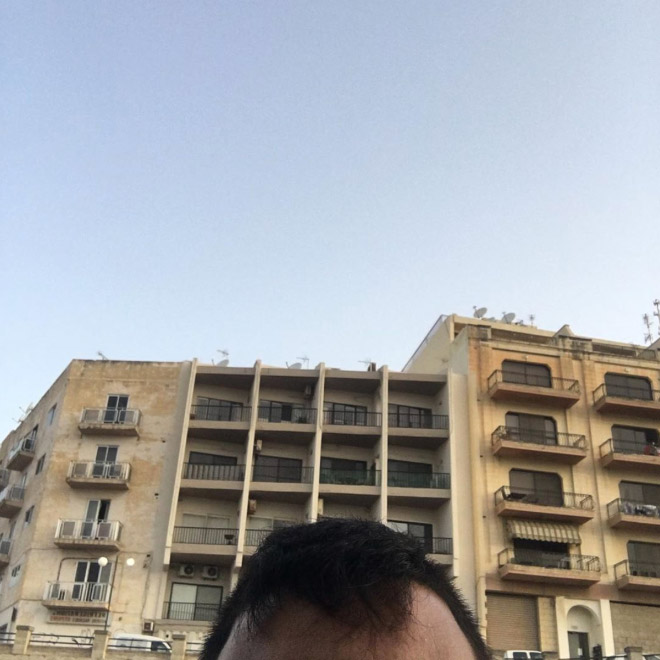 Greek Man Has Been Posting Photos of His Forehead On Instagram For The Last Six Years