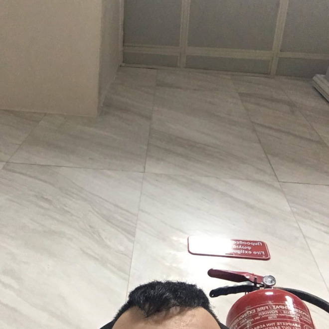 Greek Man Has Been Posting Photos of His Forehead On Instagram For The Last Six Years