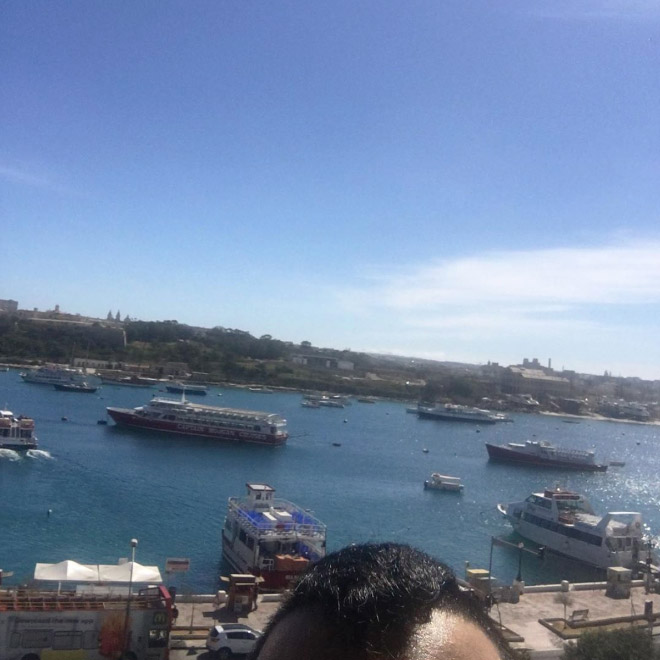 Greek Man Has Been Posting Photos of His Forehead On Instagram For The Last Six Years