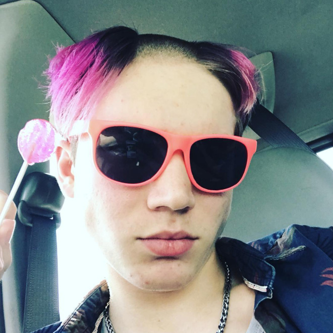 Reverse Mohawk: Awkward Instagram Haircut Trend