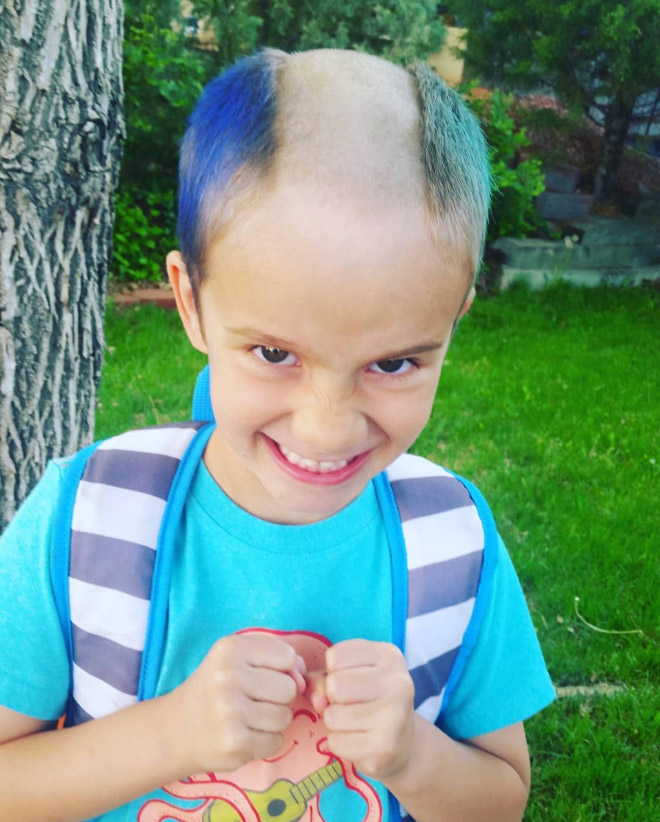Reverse Mohawk: Awkward Instagram Haircut Trend