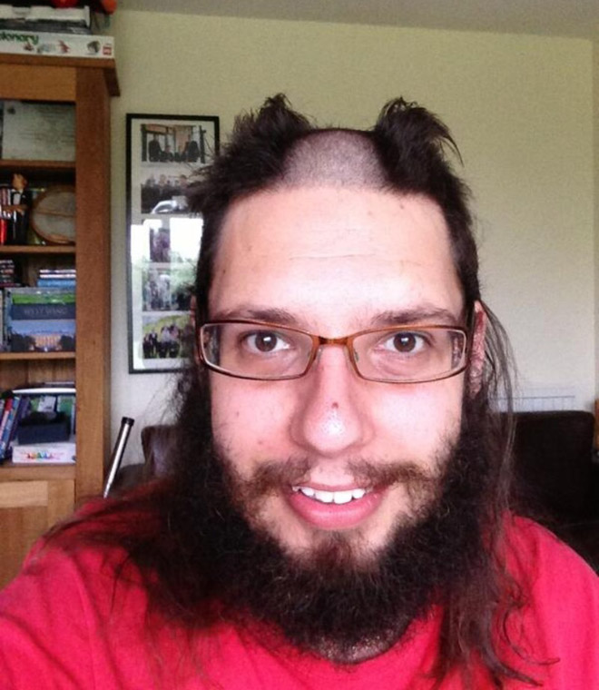 Reverse Mohawk: Awkward Instagram Haircut Trend