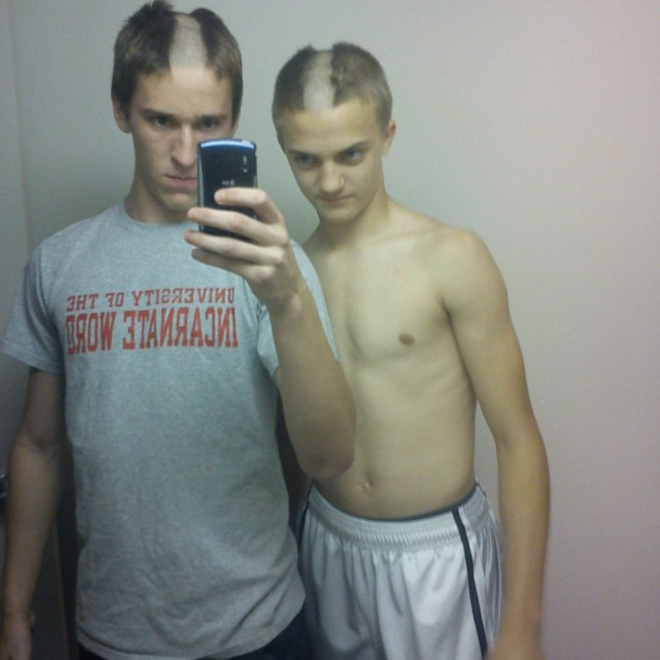 Reverse Mohawk: Awkward Instagram Haircut Trend