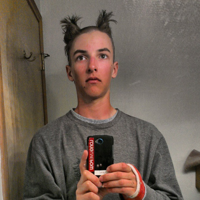 Reverse Mohawk: Awkward Instagram Haircut Trend