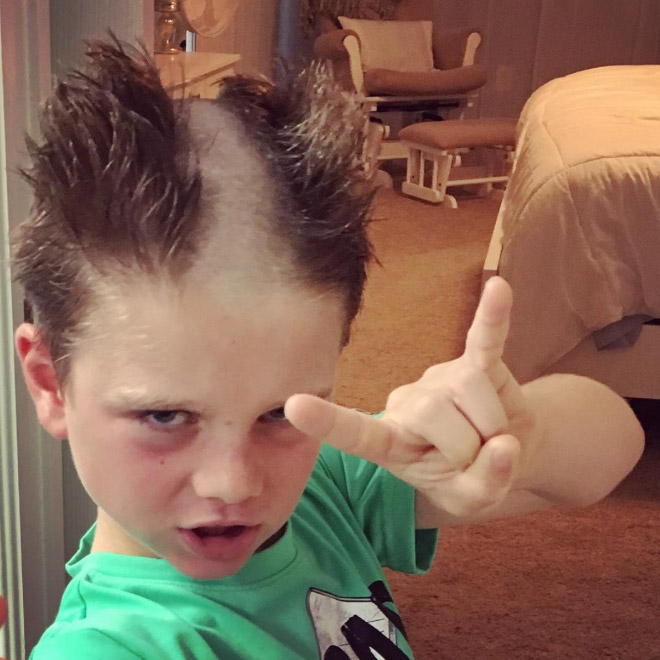 Reverse Mohawk: Awkward Instagram Haircut Trend