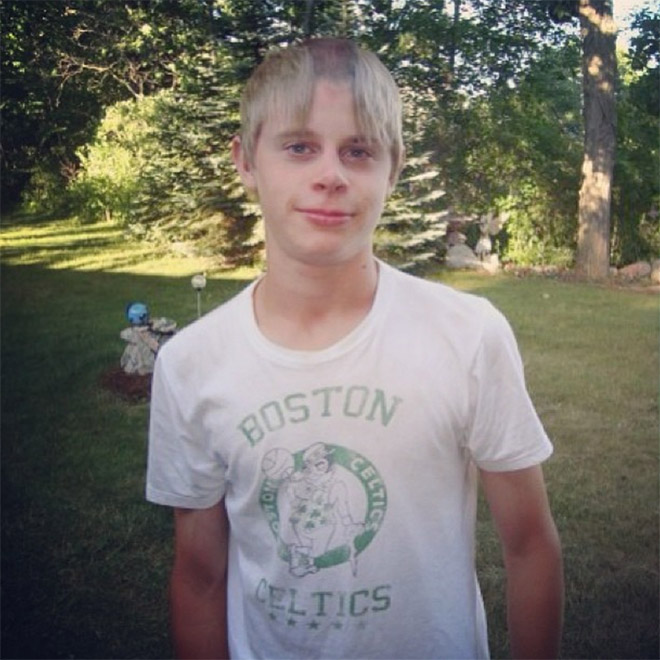 Reverse Mohawk: Awkward Instagram Haircut Trend