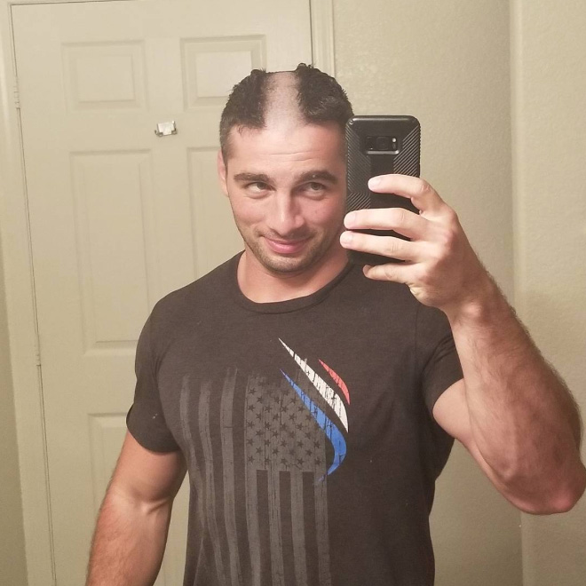 Reverse Mohawk: Awkward Instagram Haircut Trend