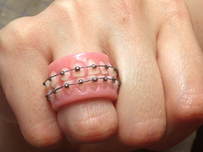 This Artist Makes Denture-Inspired Items